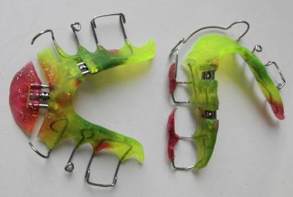 Unterkiefer-Platte mit 2 Schrauben längs in Reihe